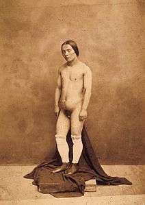 Hermaphrodite by Nadar 1.jpg